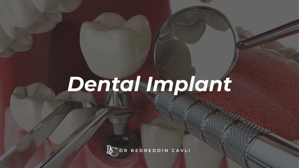 kütahya diş implantı